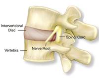 Whiplash Protection System